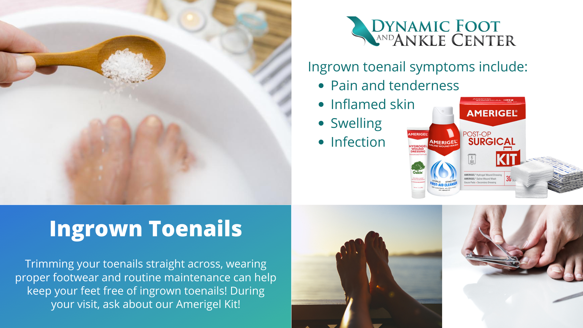 Ingrown Toenails in Fredericksburg & Lorton, VA