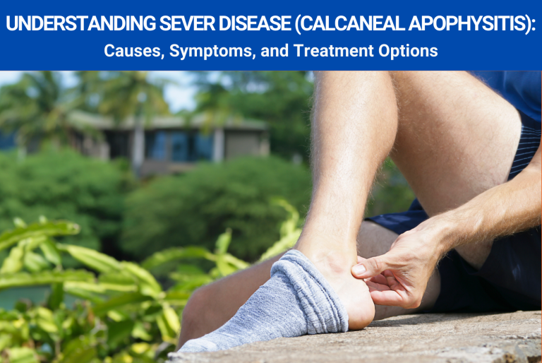 Understanding Sever Disease (Calcaneal Apophysitis): Causes, Symptoms, and Treatment Options